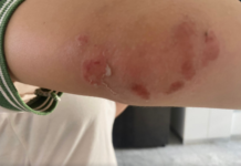 VIOLENCIA EN UNA ESCUELA DE CONCORDIA