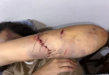 Una mujer resultó herida al ser atacada con un hacha