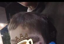 LA PEOR CARA DE LA AUSENCIA DEL ESTADO: Denuncian graves maltratos contra un niño de 2 años en Chajarí y exigen la intervención del Estado